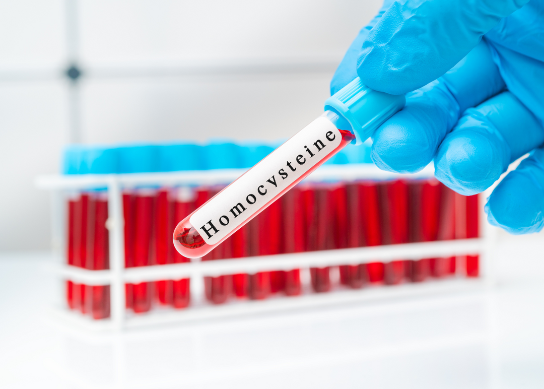 What is Homocysteine and How You Can Lower It Naturally